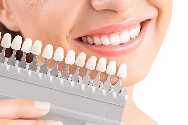 3 ĐIỀU NHẤT ĐỊNH BẠN PHẢI BIẾT ĐỂ LÀM RĂNG SỨ ĐẸP VÀ AN TOÀN